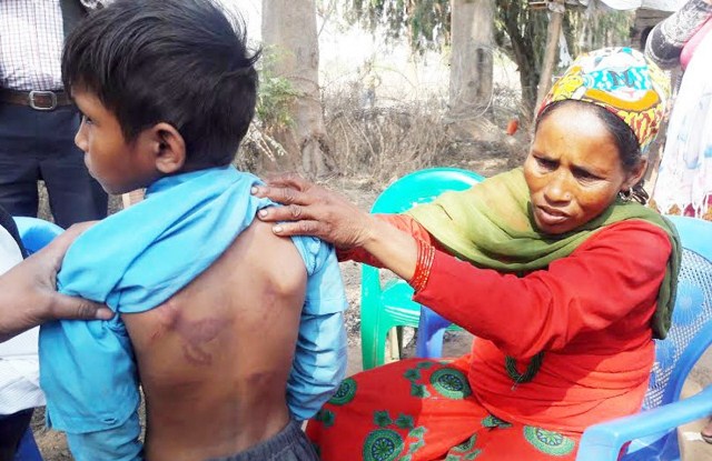 सामान छोएको भन्दै दलित नौ वर्षीय बालकमाथि निर्घात कुटपिट