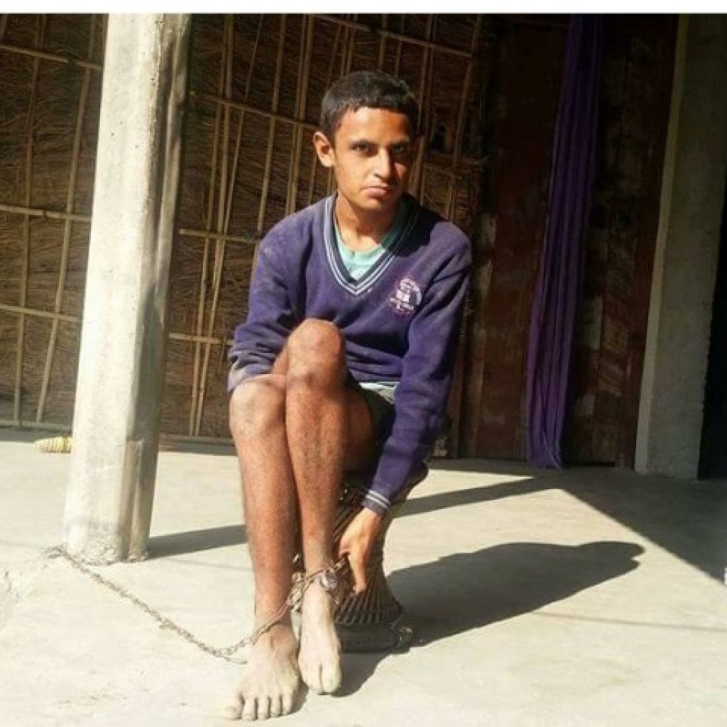 आर्थिक अभावले उपचार गराउन नसकेपछि १७ वर्षदेखि साङ्लोमा लीलाप्रसाद