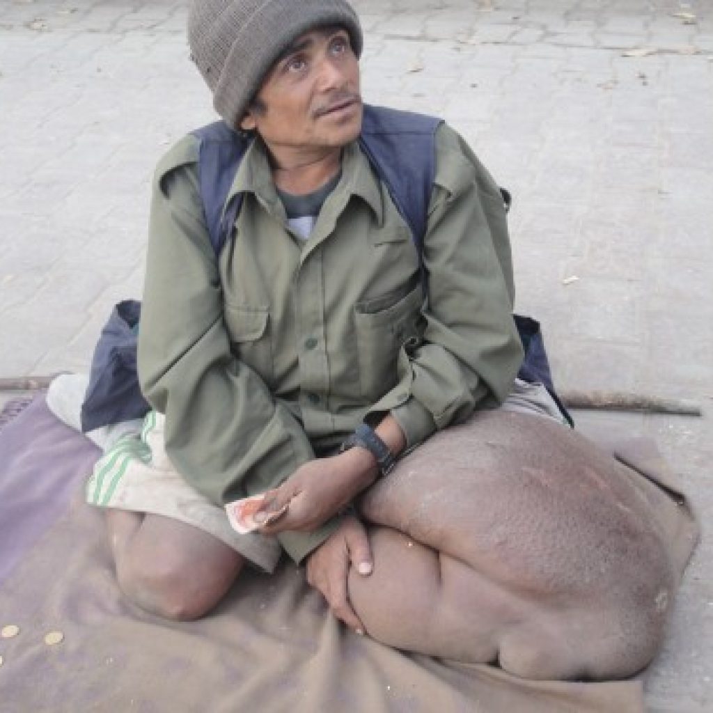 हात्तिपाइले रोग नियन्त्रणका लागि ‘औषधि सेवन गराउने अभियान’