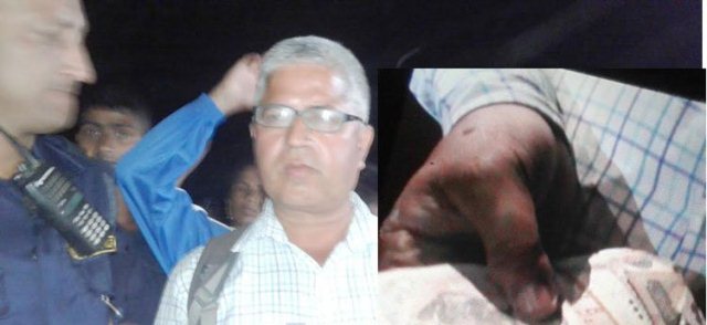 काँग्रेसका मेयर उम्मेदवारले मतदातालाई १० लाख बाँडेको खुलासा(हेर्नुहोस् भिडियोसहित)