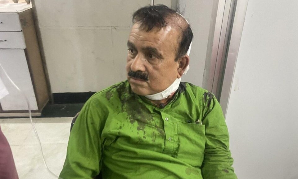 कांग्रेस सहमहामन्त्री यादवकाे आइसियुमा राखेर उपचार हुँदै