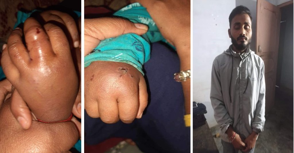 नपढेकाे भन्दै ४ वर्षीया छोरीलाई यातना दिने बाबु प्रक्राउ