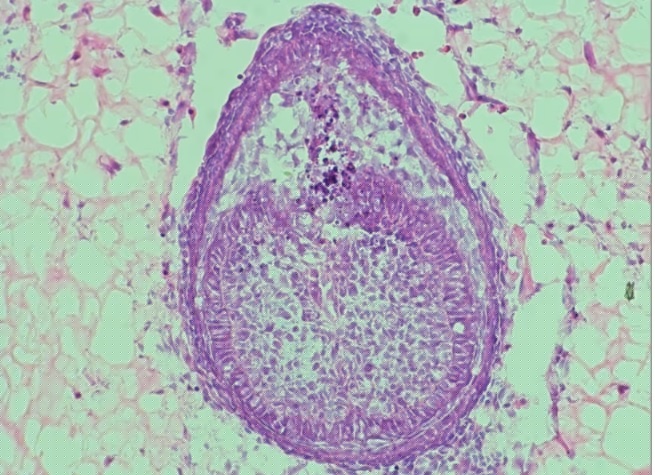 प्रयोगशालामा दाँत उब्जाउने वैज्ञानिकहरूको दौड: दन्त चिकित्साको भविष्य
