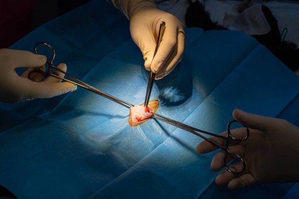 ओखलढुङ्गाको रुम्जाटार अस्पतालमा ६७ वर्षपछि पहिलो शल्यक्रिया