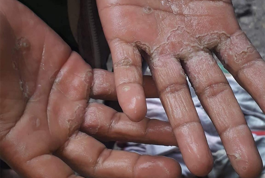 सम्बन्ध विच्छेदको प्रत्यक्ष असर बालबालिकामा : अभिभावक छुट्टिँदा स्कुल जाने उमेरका बालबालिका श्रम बजारमा