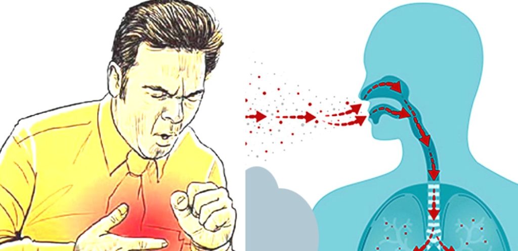 बाजुरामा पाँच वर्षमा क्षयरोगबाट १८ जनाको मृत्यु, बडीमालिका नगरपालिका उच्च जोखिममा