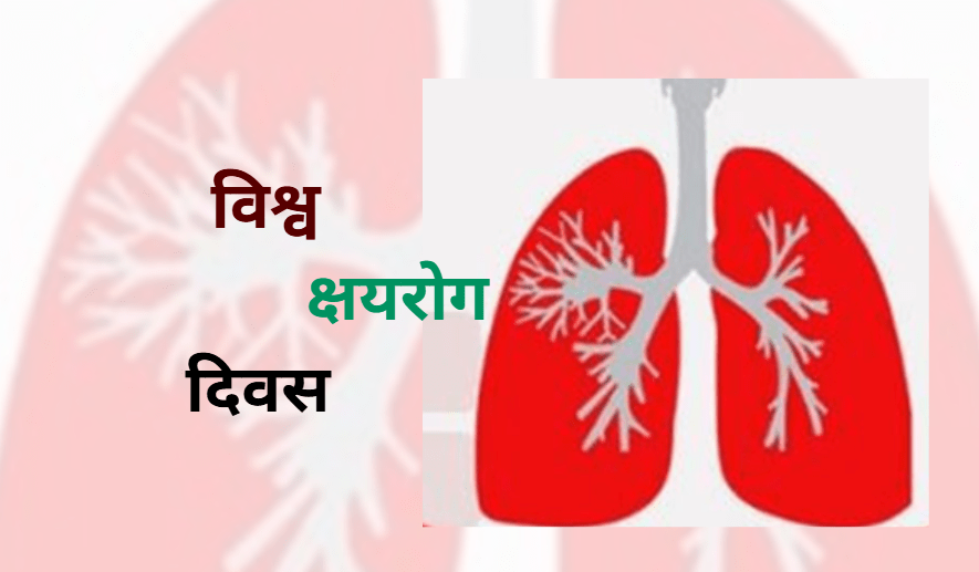 विश्व क्षयरोग दिवस : सन् २०५० सम्म नेपाललाई क्षयरोगमुक्त बनाउने संकल्पसहित मनाइँदै