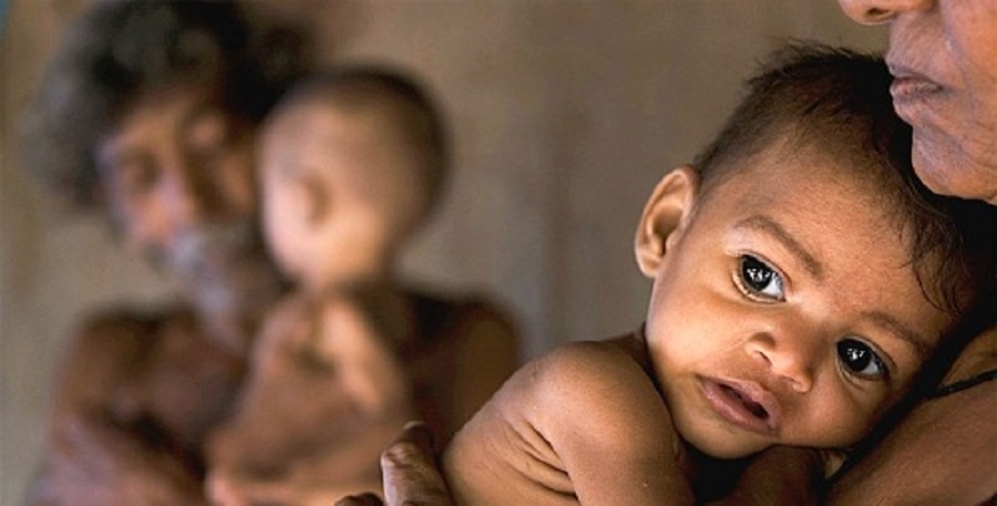 बालबालिकामा कुपोषणको अवस्था भयावह : ४ प्रतिशतमा ‘कडा’ र १२ प्रतिशतमा ‘मध्यम’ कुपोषण