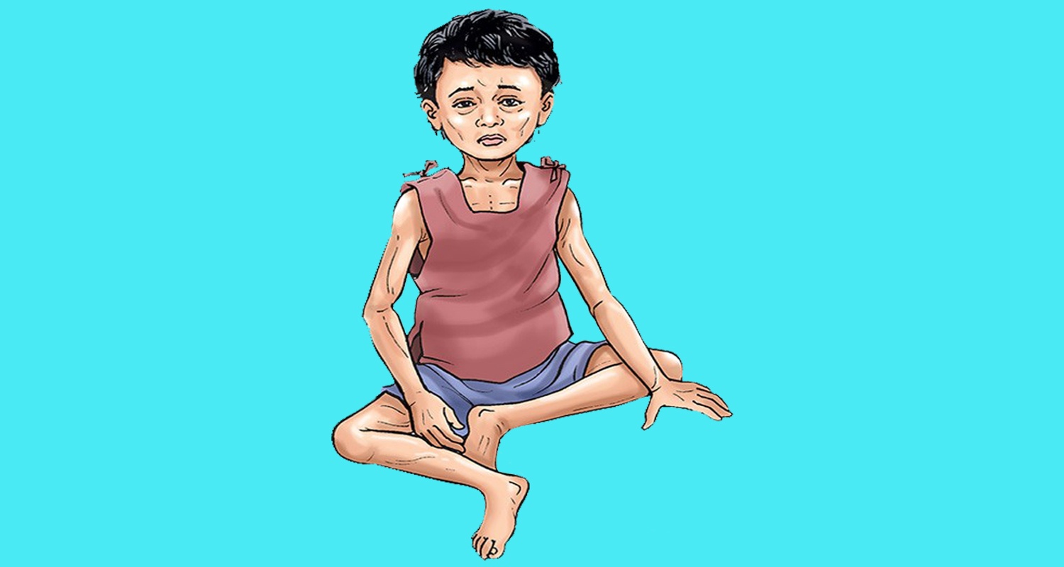 भविष्यमाथि कुपोषणको छायाँ : १८ हजार बालबालिका ‘मृत्युको छेउ’ मा