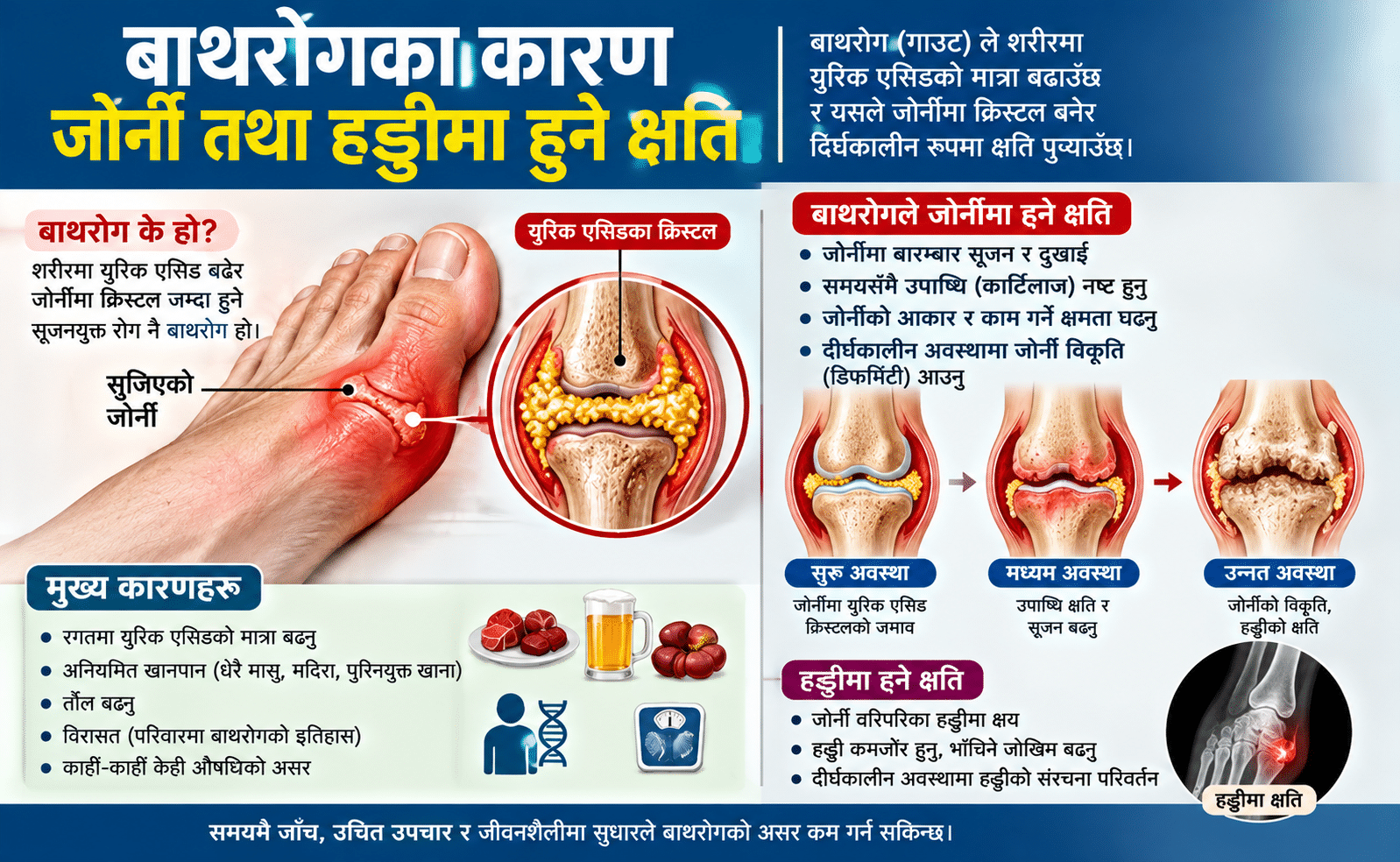 नेपालमा ३० लाखभन्दा बढी बाथरोगी: समयमै उपचार नगरे अपाङ्गताको जोखिम