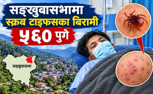 सङ्खुवासभामा स्क्रब टाइफसका बिरामी ५६० पुगे